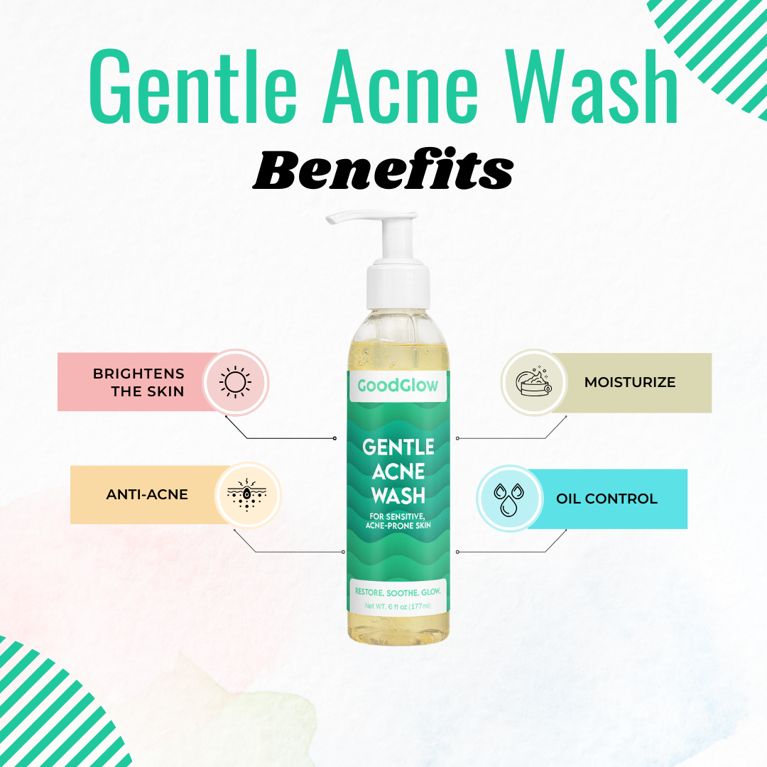 Gentle Acne Wash